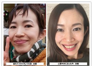 ビフォーアフター